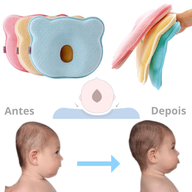Travesseiro Para Bebê Que Corrige e Previne Plagiocefalia (Anti Cabeça Achatada) - ROUND HEAD - Inov&tec