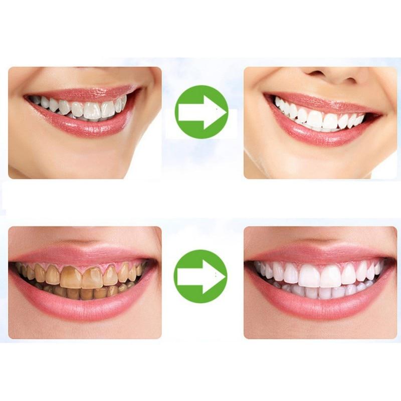 Clareador Dental Carvão Ativado Pitch Black